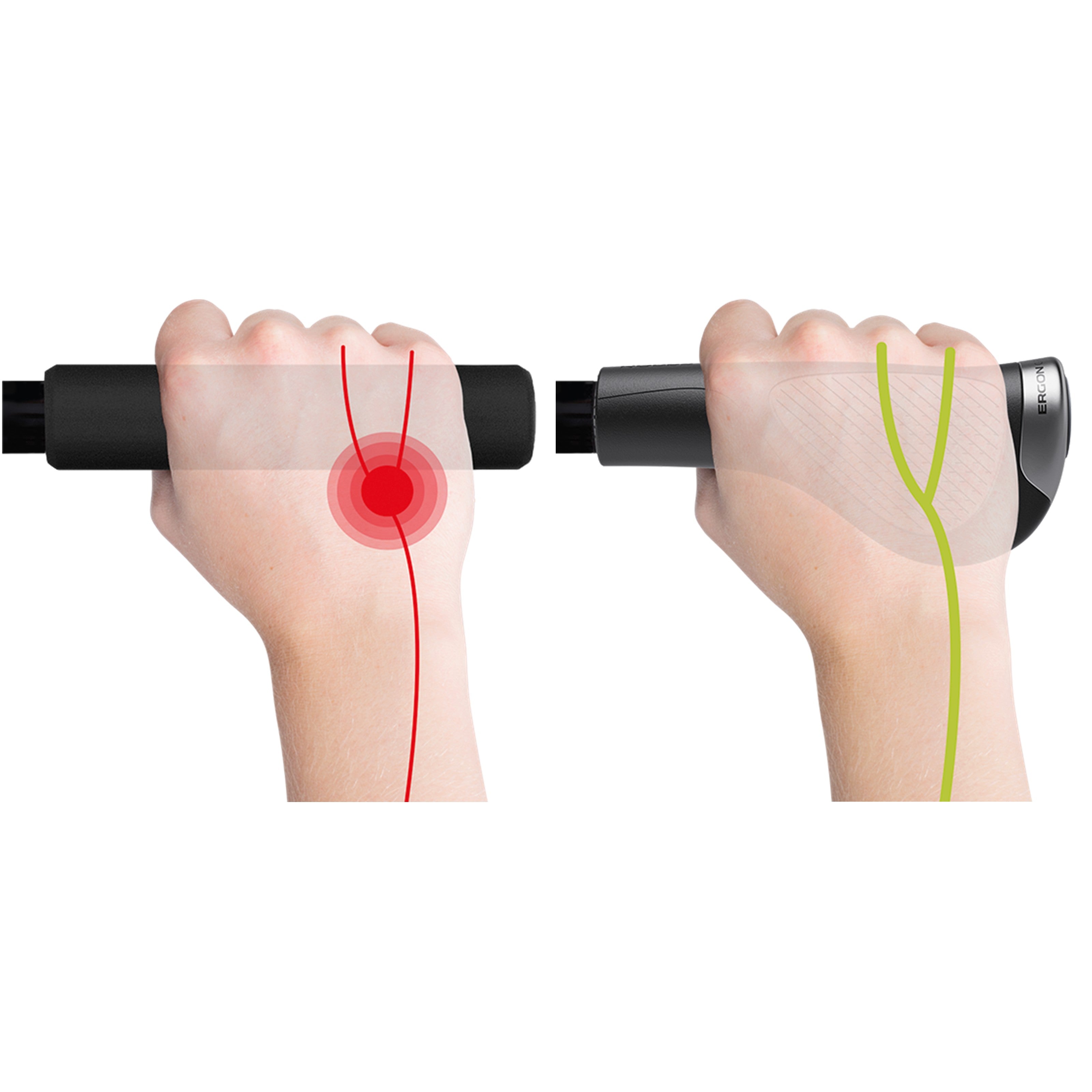 Diagram comparing hand pressure on standard grips versus Ergon GP3 Evo grips, highlighting red nerve compression point on regular grip and even pressure distribution on ergonomic grip
